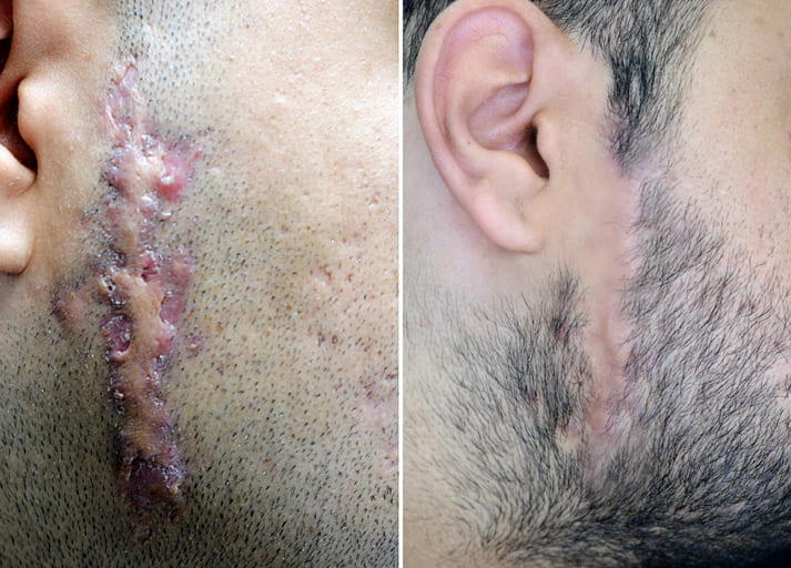 جراحی ضایعات پوستی