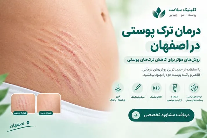 درمان ترک پوستی در اصفهان