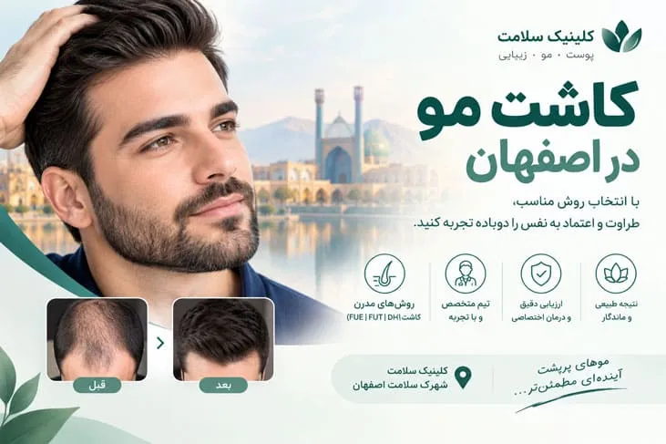کاشت مو در اصفهان