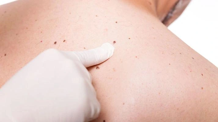 مرکز جامع سرطان و ضایعات پوستی