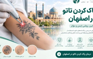پاک کردن تاتو در اصفهان