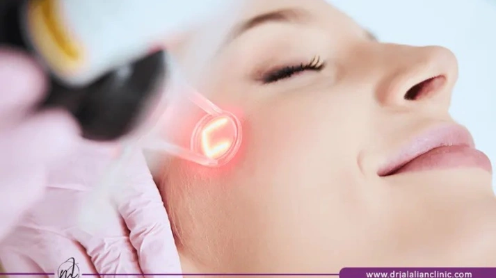 جوانسازی پوست با یولیزر