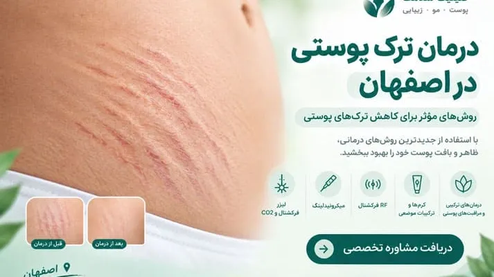 درمان ترک پوستی در اصفهان