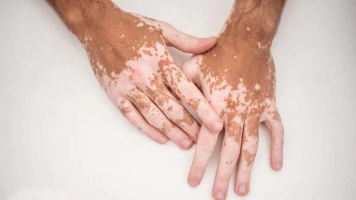 کلینیک تخصصی لک و پیس و سلول درمانی