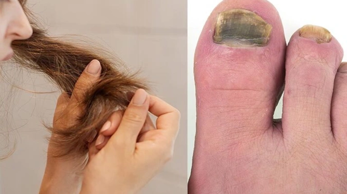 تشخیص و درمان بیماری های پوست، مو و ناخن